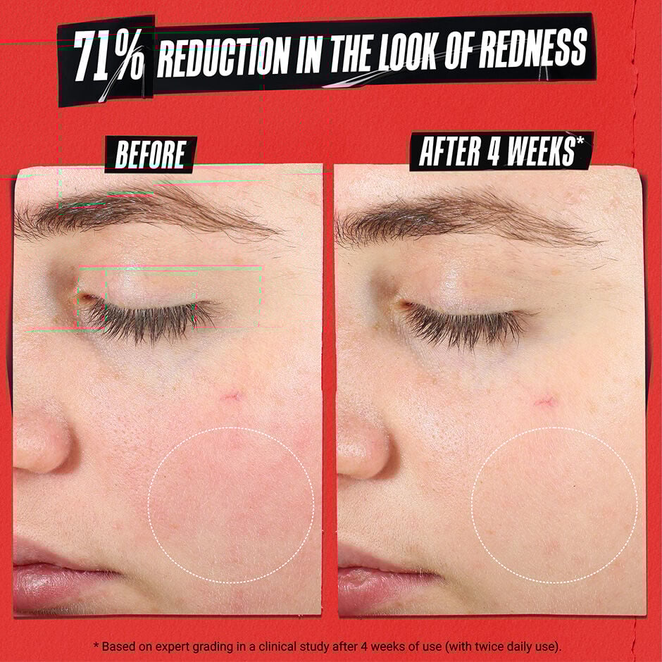 Ultra Facial Cream Medicated – Meltdown Recovery Cream with